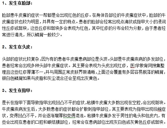 牛皮癬疾病常見的發(fā)病部位有哪些？